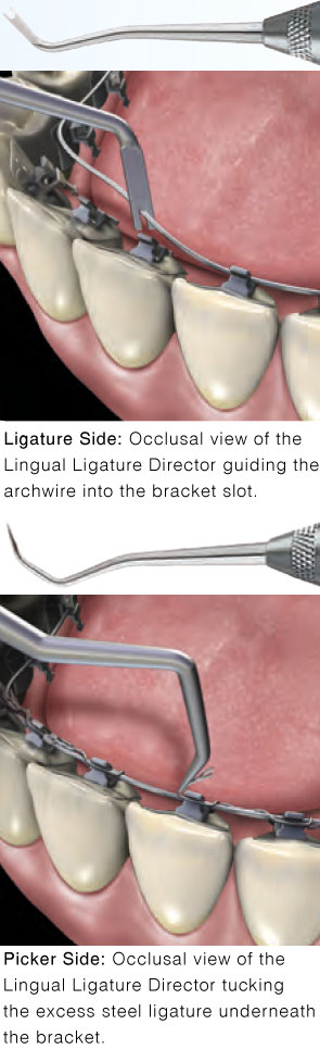 Hu-Friedy Lingual Ligature Director