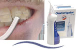Oral Irrigator