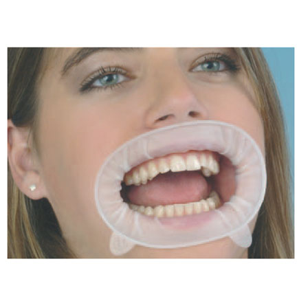 Optragate Regular Disposable Lip and Cheek Retractors