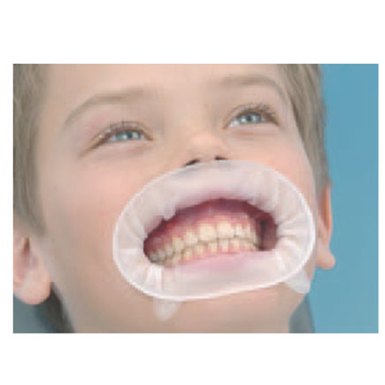 Optragate Junior Disposable Lip and Cheek Retractors