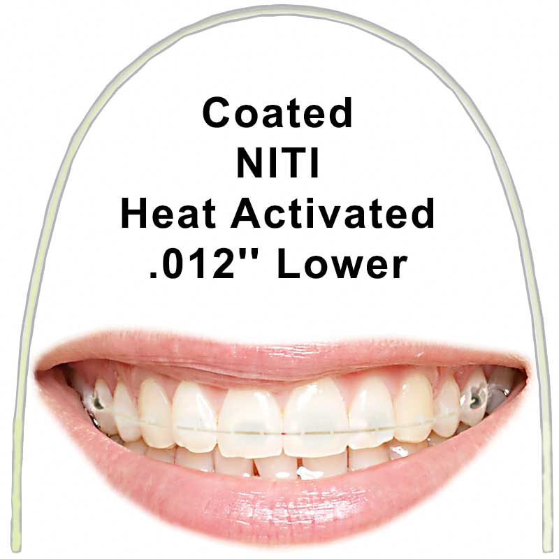 Euroform Cosmetic Heat Activated Nickel Titanium Archwires Round .012'' Lower Archwire (with Copper)