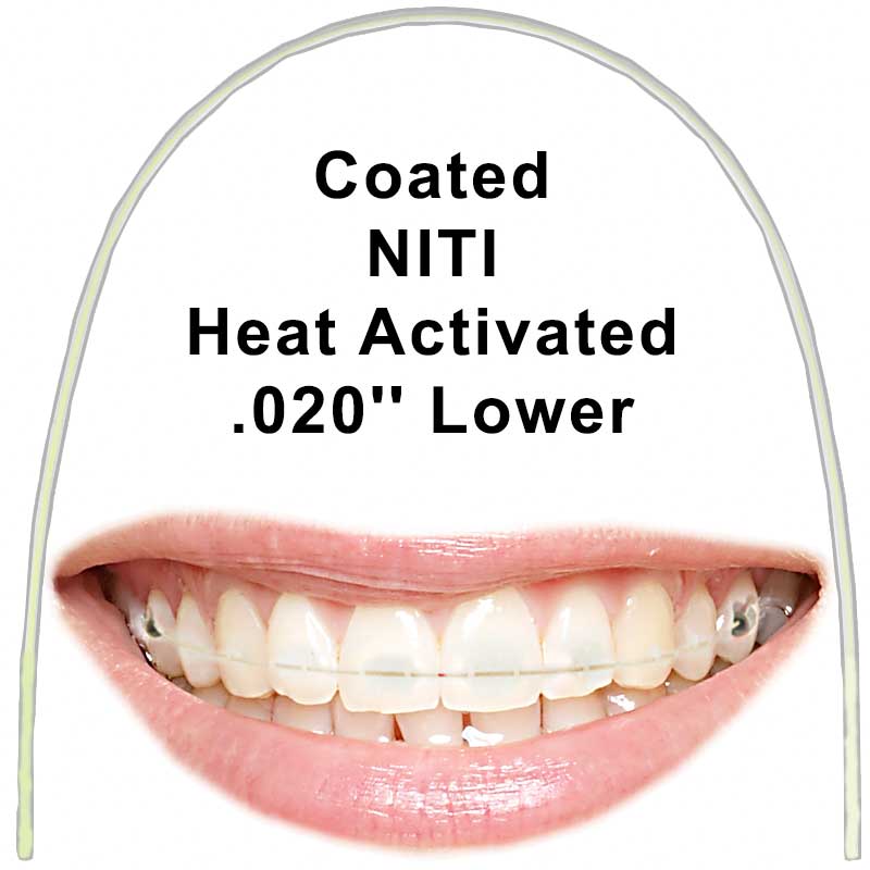 Euroform Cosmetic Heat Activated Nickel Titanium Archwires Round .020'' Lower Archwire (with Copper)