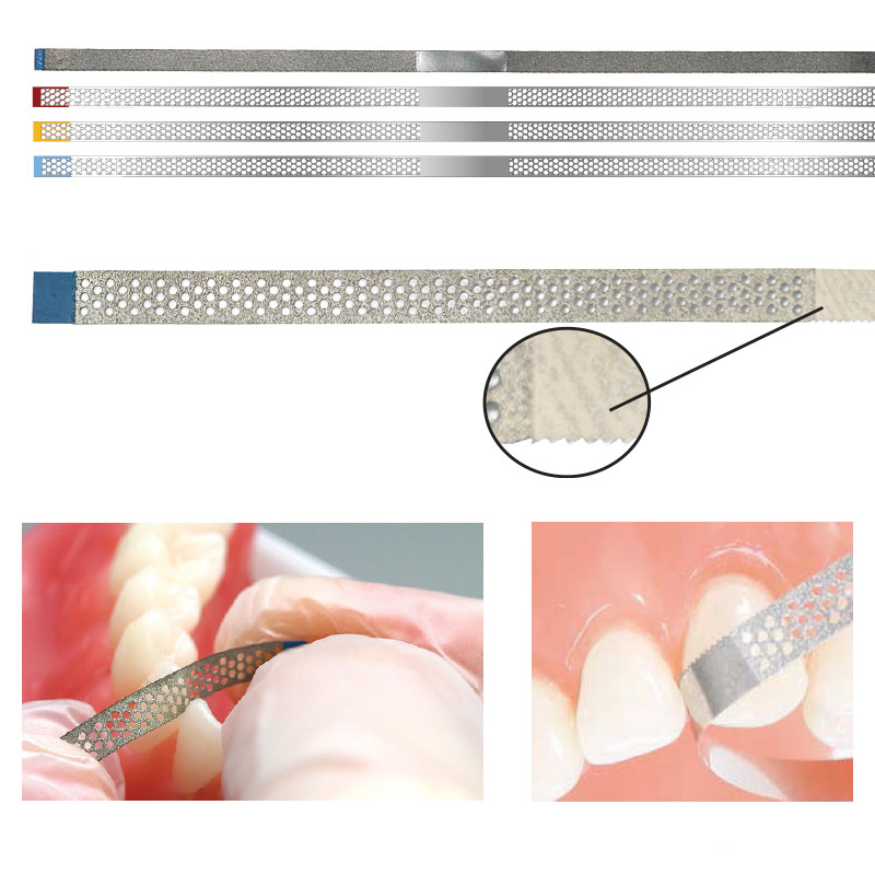 Interproximal (IPR) Strips