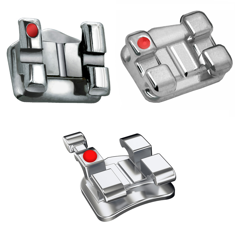 Metal Brackets