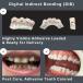 Digital Indirect Bonding (DIB)